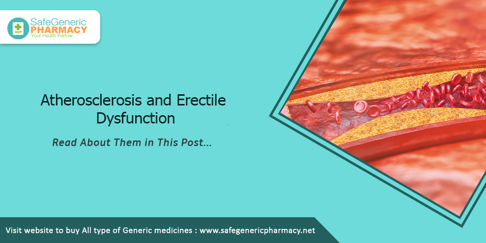 Atherosclerosis and Erectile Dysfunction 1