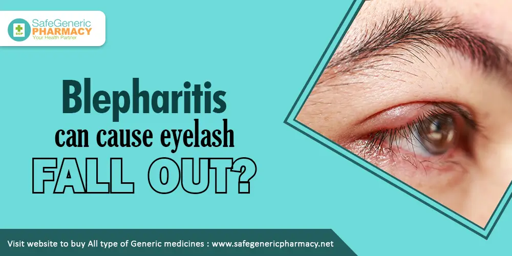 Blepharitis Can Cause Eyеlash Fall Out?